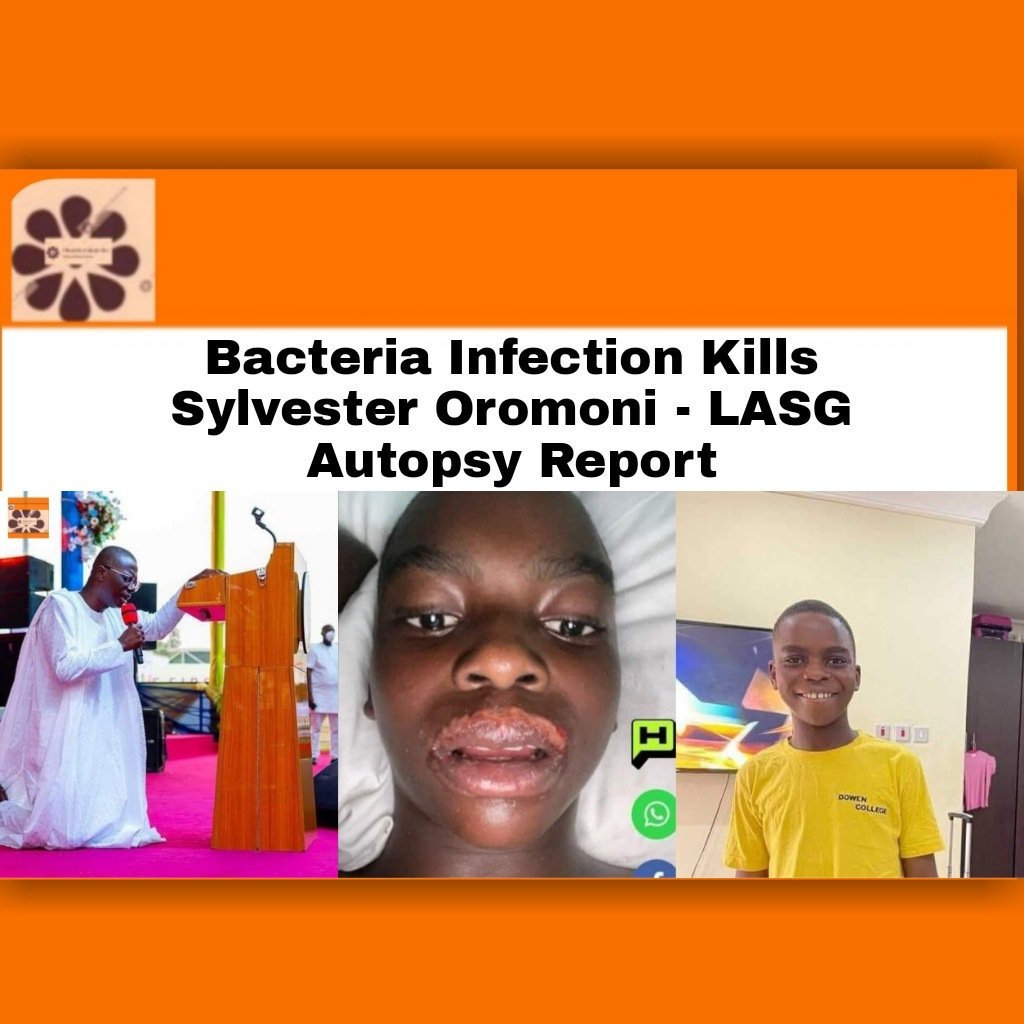 Bacteria Infection Kills Sylvester Oromoni - LASG Autopsy Report ~ OsazuwaAkonedo #– #OsazuwaAkonedo #sylvester