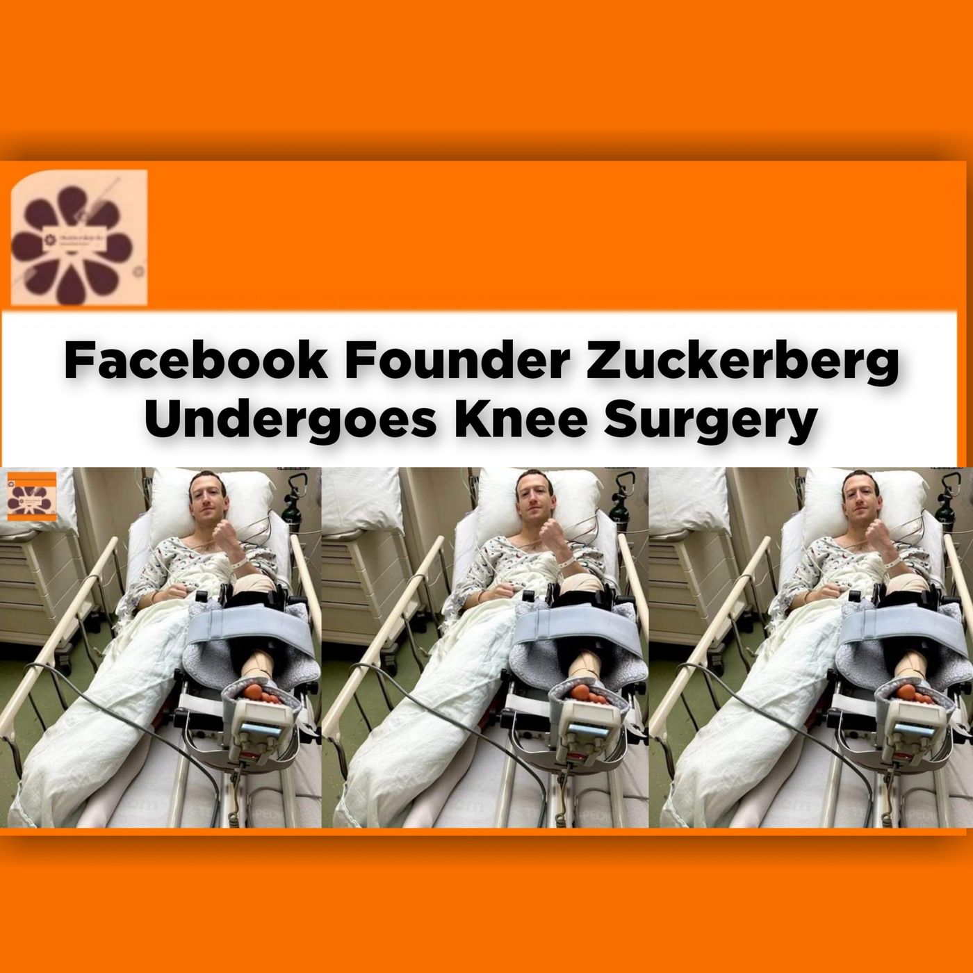 Facebook Founder Zuckerberg Undergoes Knee Surgery ~ OsazuwaAkonedo